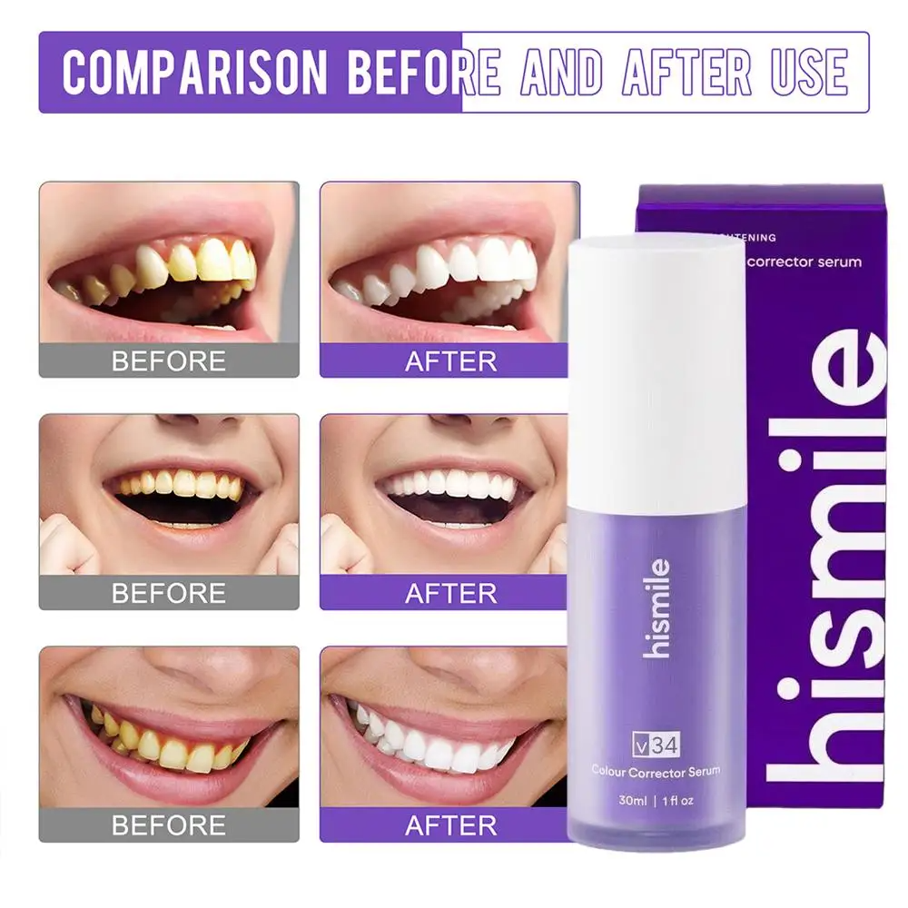 Hismile Purple Toothpaste Removes Tartar Clean Oral Hygiene Fresh Breath